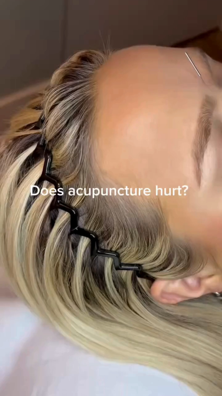 Most people are surprised that acupuncture feels like little to no pain. The needles are incredibly thin, leaving clients feeling deeply relaxed after their session.
Whether you're looking for stress relief, pain management, better sleep, or overall wellness, acupuncture is a natural way to help your body restore balance. 🌸
Ready to experience it for yourself? Book your acupuncture session today.
#acupuncture #orlandowellness #stressrelief #holistichealth